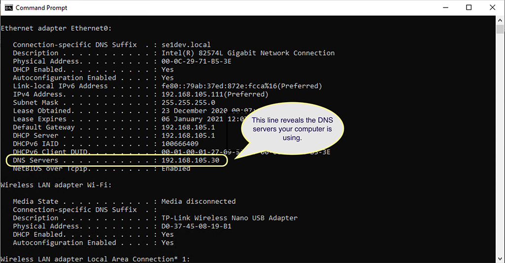 How To I Check The DNS Servers On My PC?